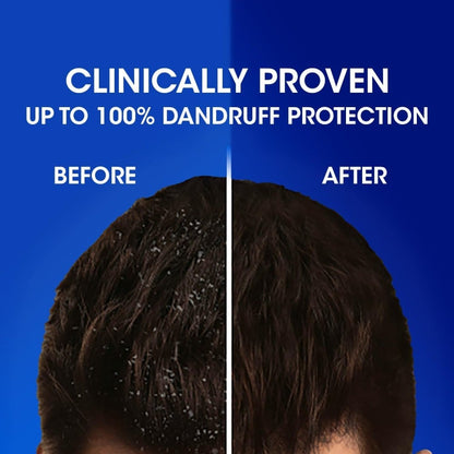 Head & Shoulders Anti Dandruff Anti Hairfall Shampoo (180ml)